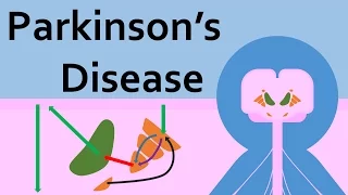 Parkinson's Disease and the Basal Ganglia