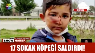 17 sokak köpeği saldırdı!