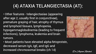 Chronic Ataxia Causes, Signs and symptoms, Diagnosis and Treatment