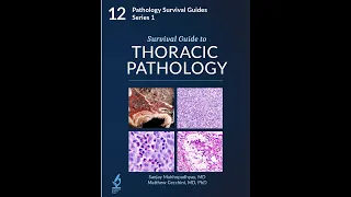 Survival Guide to Thoracic Pathology Trailer