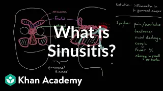 What is sinusitis? | Respiratory system diseases | NCLEX-RN | Khan Academy