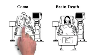 How is Brain Death Different than Coma?