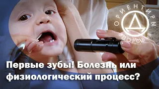 Первые зубы! Болезнь или физиологический процесс?