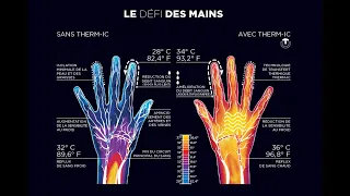 PHYSIOPATHOLOGIE DE LA THERMOREGULATION