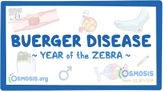 Buerger disease (Year of the Zebra)