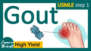 Gout | Signs and symptoms of Gout | Diagnosis of gout | Pathology and treatment of Gout | USMLE