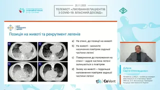 Респіраторна підтримка пацієнтів з тяжким перебігом COVID-19 (Дубров С.О.)