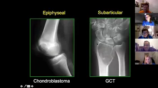 Radiologist Webinar