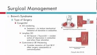 Brown's Syndrome Management