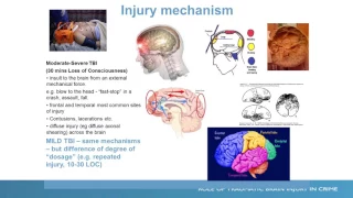 Neurobehavioral Disability and the Criminal Justice System