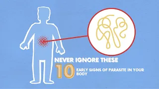 Never Ignore These 10 Early Signs Of Parasite In Your Body