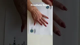 Prosthetic finger . Proteza palca. Протез пальца. Anaplastology.pl