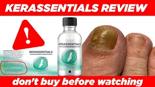 KERASSENTIALS REVIEW ⚠️( BEWARE )⚠️ Nail Fungus Treatment Oil - KERASSENTIALS Legit Reviews 2022