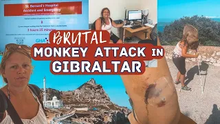 Monkey Attack in Gibraltar | Gibraltar Monkey Bite