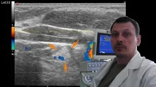 Pediatric Chest ultrasound - Thymic lesion