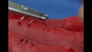 How Stitches Work