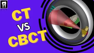 Difference Between CT and CBCT |CT and CBCT basic understanding| Fan beam vs Cone beam|