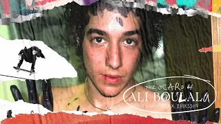 The Scars of Ali Boulala Trailer | Garage Entertainment