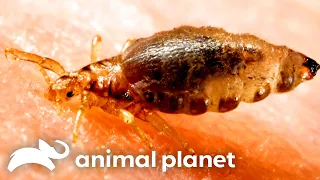 Botfly Larvae Living In Young Woman's Scalp!? | Monsters Inside Me | Animal Planet