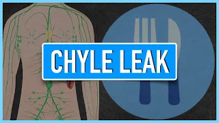 Chyle Leak | Emphasis on Diet/Nutrition
