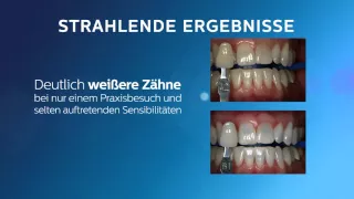 Philips Zoom Bleaching