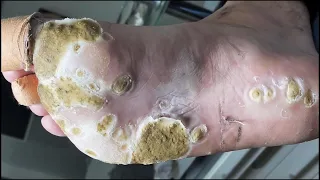 So satisfying,Professional Foot Care-Best Pedicure