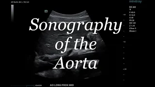 SONOGRAPHY OF THE AORTA