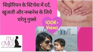 CESAREAN STITCHES PAIN home care |सिझेरियन के स्टिचेस में दर्द, खुजली और नम्बनेस के घरेलू नुक्से