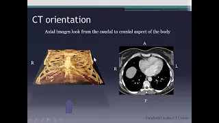 Cardiac CT anatomy