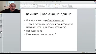 Миелопролиферативные заболевания  Хронический миелолейкоз, идиопатический миелофиброз  Полицитемия