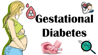 Gestational Diabetes (GDM/Diabetes In Pregnancy)- Causes, Pathogenesis, Signs & Symptoms & Treatment