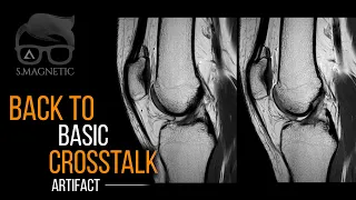 BACK TO BASIC – CROSSTALK ARTIFACT