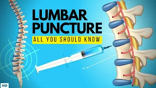 Lumbar Puncture:  Everything You Need to Know