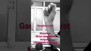 GANGLION CYST Non-cancerous lump, often on the joints or tendons of wrist & hand.