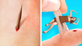 If a SPLINTER Was A PERSON!😼 LIFE-SAVING Hacks For Clumsy People