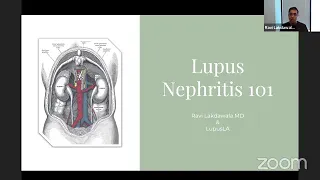 Lupus Nephritis 101 with Nephrologist, Dr. Ravi Lakdawala