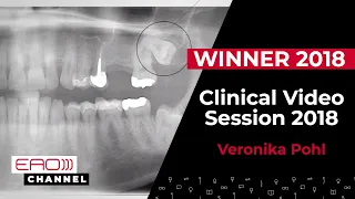 WINNER : Veronika Pohl -  Clinical Video Session 2018