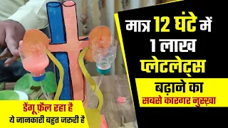 1 लाख प्लेटलेट्स मात्र 12 घंटे में बढ़ाने का सबसे कारगर नुस्ख़ा