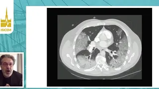 Progress in pulse oximetry F.Michard