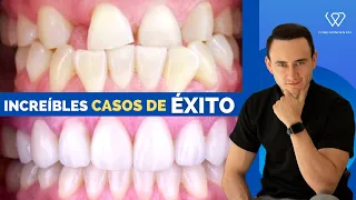 ¡Estos dentistas le cambiaron la vida a sus pacientes! Increíbles casos de Antes y después.