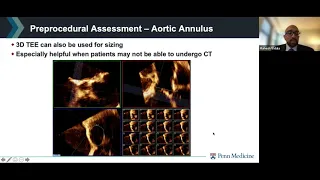 Joint Echo Conference: Structural Heart AV Intervention