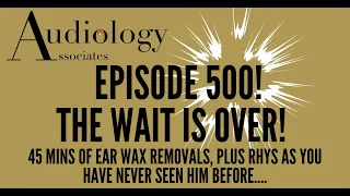 45 MINS OF EAR WAX REMOVALS (WITH A TWIST) - EP500