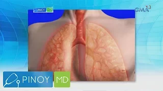 Pinoy MD: Sakit na pneumonia, paano nga ba maiiwasan?