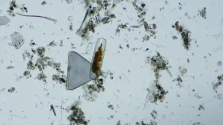 Antarctic Diatoms (25x) from McMurdo Sound Seafloor