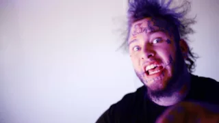 Stitches  Fucked Up  Official Music Video  produced by@jimmyduvalmusic