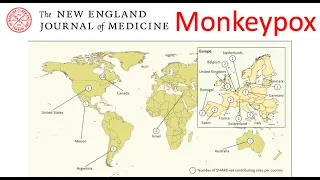 Monkeypox, sexual spread confirmed