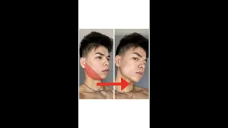 HOW DO I GET A SHARPER JAWLINE WITHOUT SURGERY?