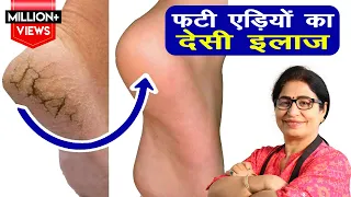 क्या आप भी फटी एड़ियों से परेशान है ? अब 1 ही रात में पाये फटी एड़ियों से छुटकारा | Homemade Cream