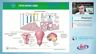 Аномальні маткові кровотечі: роль офісної гістероскопії (Медведєв М.В.)