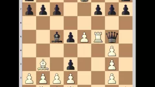 Wonderfully Entertaining chess game: Adolf Anderssen vs Max Lange